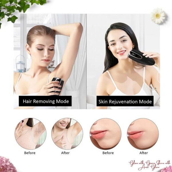 Portable IPL Laser Hair Removal Device for Home Use & Skin Rejuvenation - Image 2